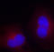 Protein Tyrosine Kinase 2 antibody, STJ22356, St John