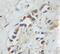 USH1 Protein Network Component Harmonin antibody, 11358-1-AP, Proteintech Group, Immunohistochemistry paraffin image 