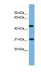 CTD Small Phosphatase 2 antibody, NBP1-55471, Novus Biologicals, Western Blot image 