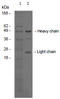 Kinase Insert Domain Receptor antibody, AM26786PU-N, Origene, Western Blot image 
