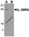 Interleukin 36 Receptor Antagonist antibody, 7511, ProSci, Western Blot image 