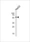 Nuclear Receptor Subfamily 1 Group H Member 2 antibody, LS-C162985, Lifespan Biosciences, Western Blot image 