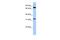 TATA-Box Binding Protein Associated Factor 6 antibody, PA5-41502, Invitrogen Antibodies, Western Blot image 