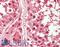 Histone Deacetylase 10 antibody, LS-B10812, Lifespan Biosciences, Immunohistochemistry paraffin image 