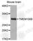 Transmembrane Protein 106B antibody, A3441, ABclonal Technology, Western Blot image 