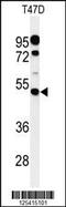 GPI mannosyltransferase 1 antibody, 61-649, ProSci, Western Blot image 