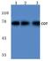 Mitogen-Activated Protein Kinase Kinase Kinase 8 antibody, A01696-1, Boster Biological Technology, Western Blot image 