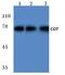 Mitogen-Activated Protein Kinase Kinase Kinase 8 antibody, A01696-1, Boster Biological Technology, Western Blot image 