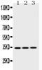 Emerin antibody, A00714, Boster Biological Technology, Western Blot image 