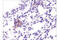 PD-L1 antibody, 64988T, Cell Signaling Technology, Immunohistochemistry paraffin image 