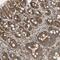 Murine Retrovirus Integration Site 1 Homolog antibody, PA5-52592, Invitrogen Antibodies, Immunohistochemistry frozen image 