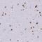 SATB Homeobox 2 antibody, NBP2-52900, Novus Biologicals, Immunohistochemistry frozen image 
