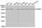 Interferon Alpha And Beta Receptor Subunit 2 antibody, MBS126741, MyBioSource, Western Blot image 