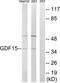 Growth Differentiation Factor 15 antibody, TA312174, Origene, Western Blot image 