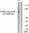 Forkhead Box O1 antibody, A00073T24-1, Boster Biological Technology, Western Blot image 