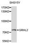 Grainyhead Like Transcription Factor 2 antibody, STJ112192, St John