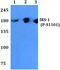 Insulin Receptor Substrate 1 antibody, PA5-36719, Invitrogen Antibodies, Western Blot image 