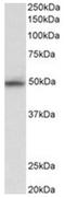 Mitogen-Activated Protein Kinase 9 antibody, AP31925PU-N, Origene, Western Blot image 