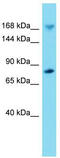 IQ Motif Containing GTPase Activating Protein 2 antibody, TA337967, Origene, Western Blot image 