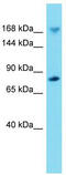 Ras GTPase-activating-like protein IQGAP2 antibody, TA337967, Origene, Western Blot image 