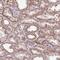 Dishevelled Associated Activator Of Morphogenesis 2 antibody, PA5-62373, Invitrogen Antibodies, Immunohistochemistry frozen image 