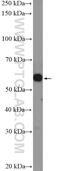 Golgi Associated Kinase 1B antibody, 25994-1-AP, Proteintech Group, Western Blot image 