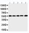 Matrix Metallopeptidase 12 antibody, LS-C313255, Lifespan Biosciences, Western Blot image 