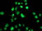 SAM And HD Domain Containing Deoxynucleoside Triphosphate Triphosphohydrolase 1 antibody, TA502024, Origene, Immunofluorescence image 