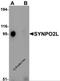 Synaptopodin 2 Like antibody, 6053, ProSci, Western Blot image 