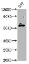 Glutamic--Pyruvic Transaminase 2 antibody, CSB-PA823460LA01HU, Cusabio, Western Blot image 
