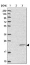 Zinc Finger Protein 501 antibody, NBP2-13577, Novus Biologicals, Western Blot image 