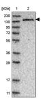 Ubiquitin Conjugating Enzyme E2 O antibody, PA5-54839, Invitrogen Antibodies, Western Blot image 