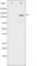 Integrin Subunit Beta 3 antibody, abx011024, Abbexa, Western Blot image 