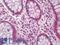 Chemokine-like factor antibody, LS-B12531, Lifespan Biosciences, Immunohistochemistry paraffin image 