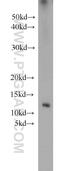 Guanylate Cyclase Activator 2B antibody, 18113-1-AP, Proteintech Group, Western Blot image 