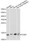 S100 Calcium Binding Protein P antibody, LS-C749761, Lifespan Biosciences, Western Blot image 