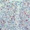 Cyclin Dependent Kinase 2 antibody, LS-C88197, Lifespan Biosciences, Immunohistochemistry frozen image 
