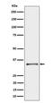Cytochrome B5 Reductase 3 antibody, M03487-2, Boster Biological Technology, Western Blot image 