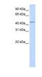 SPARC (Osteonectin), Cwcv And Kazal Like Domains Proteoglycan 3 antibody, NBP1-59686, Novus Biologicals, Western Blot image 