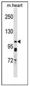 Potassium Voltage-Gated Channel Subfamily Q Member 5 antibody, AP52318PU-N, Origene, Western Blot image 