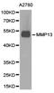 Matrix Metallopeptidase 13 antibody, LS-C192837, Lifespan Biosciences, Western Blot image 