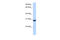 Dual Specificity Phosphatase 19 antibody, 30-831, ProSci, Enzyme Linked Immunosorbent Assay image 