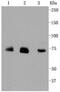 5'-Aminolevulinate Synthase 1 antibody, NBP2-67300, Novus Biologicals, Western Blot image 