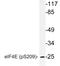 Eukaryotic Translation Initiation Factor 4E antibody, LS-C178024, Lifespan Biosciences, Western Blot image 