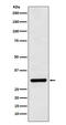 BCL10 Immune Signaling Adaptor antibody, M01616-3, Boster Biological Technology, Western Blot image 