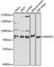 Protein NEDD1 antibody, 19-536, ProSci, Western Blot image 