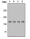 Carbamoyl-Phosphate Synthase 1 antibody, LS-C667731, Lifespan Biosciences, Western Blot image 