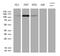 PMS1 Homolog 1, Mismatch Repair System Component antibody, M04425, Boster Biological Technology, Western Blot image 