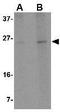 Regulator Of Calcineurin 2 antibody, GTX31373, GeneTex, Western Blot image 