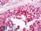Phosducin Like 2 antibody, LS-B11786, Lifespan Biosciences, Immunohistochemistry paraffin image 